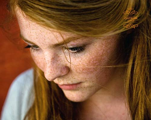  Nám da thường xuất hiện khi nội tiết tố thay đổi trong quá trình mang thai.