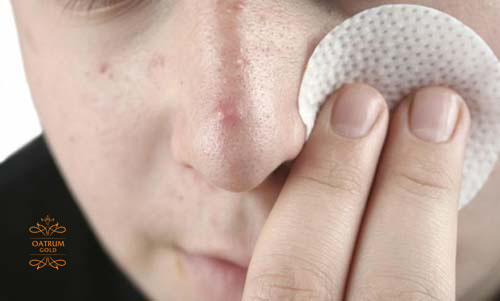    Mụn bọc ở mũi hay bắt gặp ở người có da nhờn và lười rửa mặt.