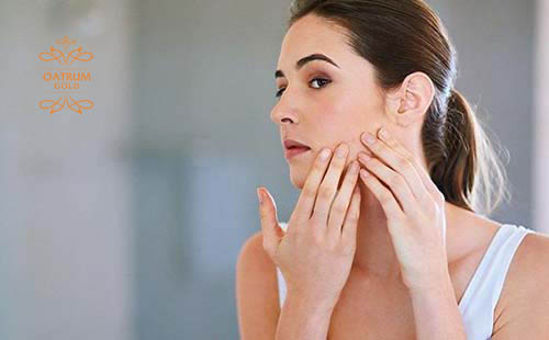 Sự thay đổi nội tiết tố là nguyên nhân hàng đầu gây ra mụn trứng cá dạng nang.