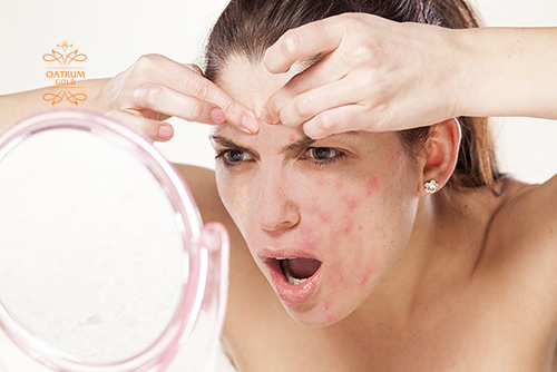 Không tự ý nặn mụn bọc dưới bất cứ hình thức nào