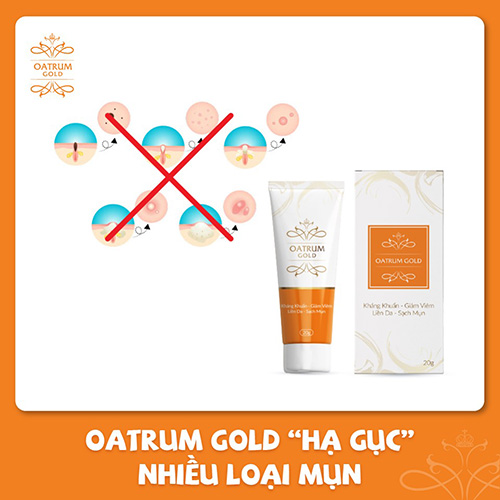  Oatrum Gold có thể hạ gục nhiều loại mụn nhờ ứng dụng thành công hoạt chất Berberine 
