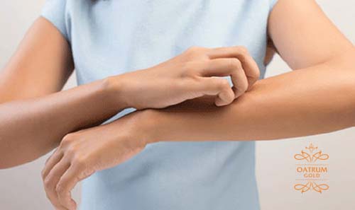 Sẹo lồi bị ngứa chủ yếu là do sẹo kích hoạt dây thần kinh ngứa.