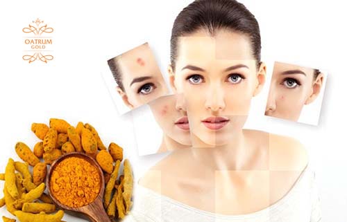 Xoá sẹo lồi hiệu quả với các nguyên liệu thiên nhiên.