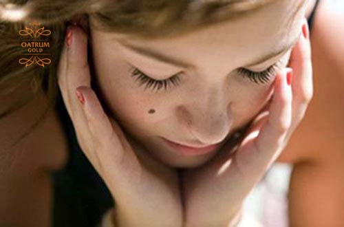  Sẹo lõm chính là hệ quả do việc tẩy nốt ruồi để lại, nhất là nốt ruồi có chân sâu.