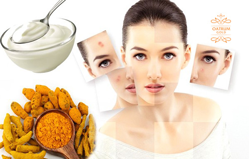 Nghệ tươi kết hợp với sữa chua là cách trị mụn bọc sưng đỏ hiệu quả