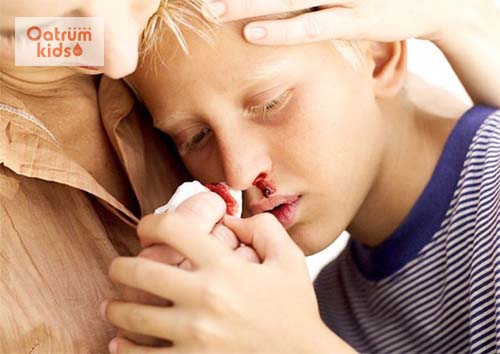  Bệnh Hemophilia là một bệnh hiếm gặp