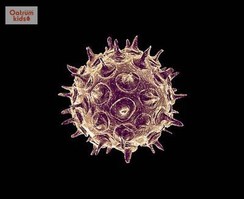  Virus varicella-zoster gây bệnh thủy đậu