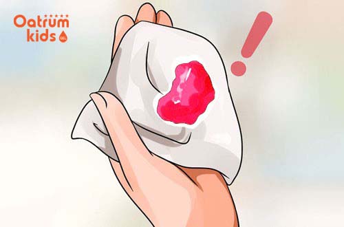 Ra huyết hồng nhưng không đau bụng là dấu hiệu đầu của việc chuyển dạ.