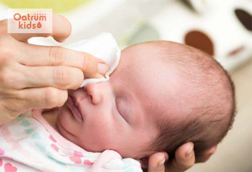 Trẻ sơ sinh bị tắc tuyến lệ do nhiều nguyên nhân