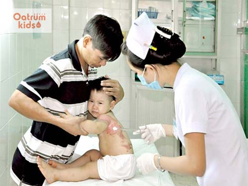  Tùy vào mức độ bỏng nước sôi của trẻ mà sẽ có cách điều trị cụ thể