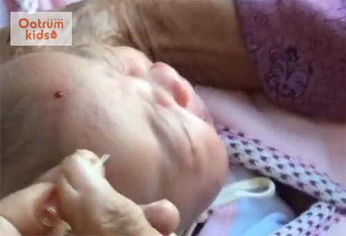 Lễ đẹn là phương pháp trị bệnh dân gian chưa được y học công nhận