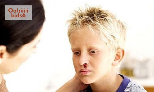  Chảy máu cam có thể là dấu hiệu của bệnh lý