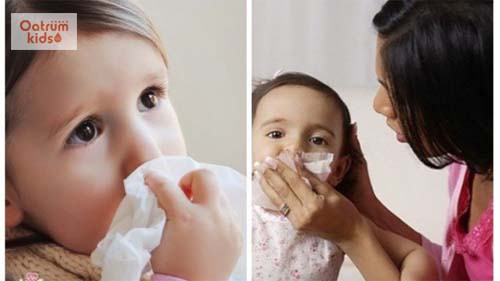  Xử lý đúng cách khi trẻ bị chảy máu cam