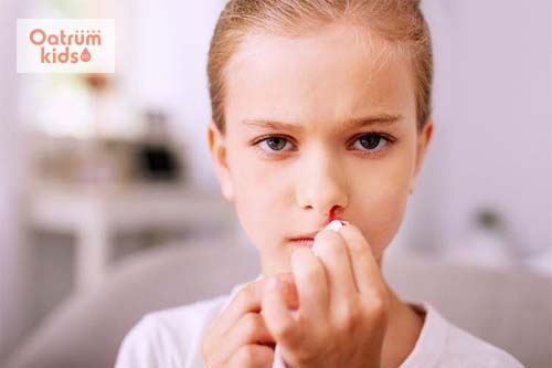  Chảy máu cam ở trẻ có thể là hiện tượng bình thường khi thời tiết nắng nóng