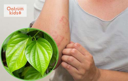 Bài thuốc trị mề đay từ lá trầu không