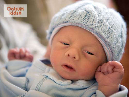  Hội chứng Edwards ở trẻ em