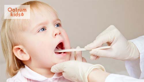  Cần điều trị triệt để viêm họng hạt tránh tái phát lại