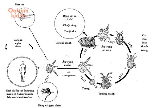 Bệnh sốt mò do vi khuẩn kí sinh trên động vật gặm nhấm gây nên