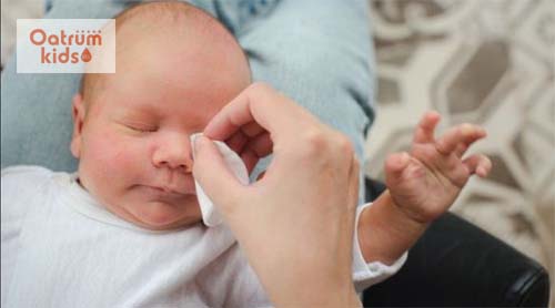  Sưng mí mắt khiến trẻ đau nhức, khó chịu