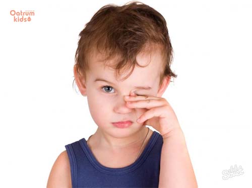  Dấu hiệu bị cận thị ở trẻ em qua biểu hiện dụi mắt nhiều