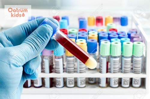  Bác sĩ sẽ thực hiện một số xét nghiệm để chẩn đoán bệnh nhiễm trùng máu