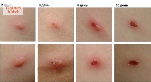  Triệu chứng phỏng dạ qua từng giai đoạn