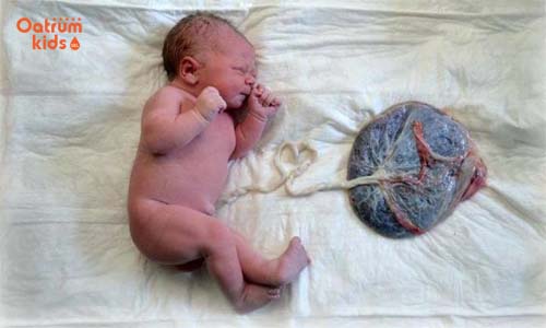 Sinh thuận tự nhiên tức là để cho dây rốn của bé tự rụng.