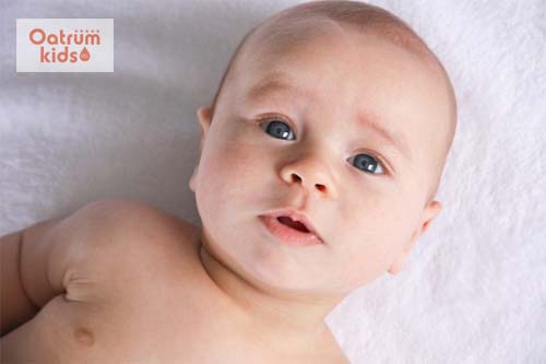  Tật vẹo cổ ở trẻ sơ sinh