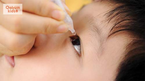  Sử dụng thuốc nhỏ mắt điều trị cận thị cho trẻ