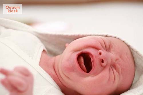  Hội chứng Colic là một trong những nguyên nhân khiến trẻ sơ sinh bị đau bụng