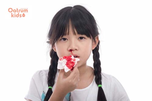 Chảy máu cam có thể phát triển thành nhiễm trùng niêm mạc mũi