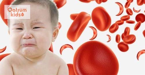 Bệnh thiếu máu ở trẻ em