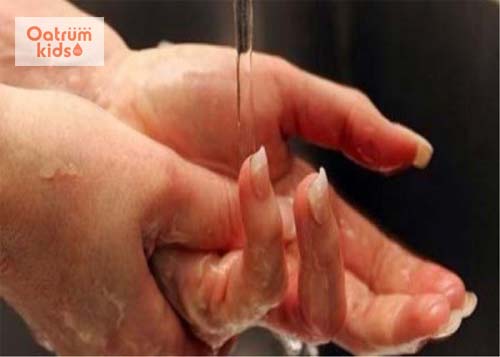  Ngâm vùng da bị bỏng vào nước mát giúp làm dịu da