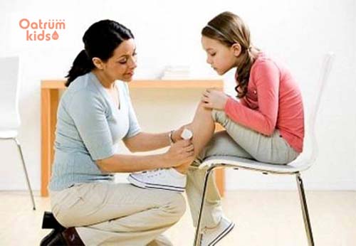  Bỏng bô xe máy ở trẻ là tai nạn không hề nhẹ