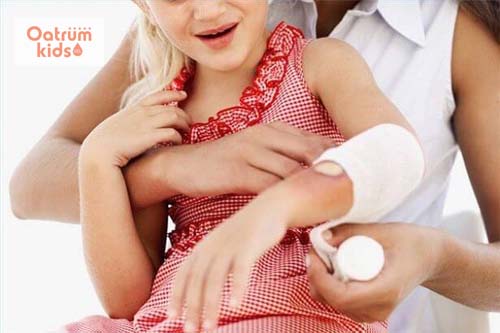  Băng vết bỏng bằng gạc y tế giúp bảo vệ tổn thương khỏi tác hại môi trường