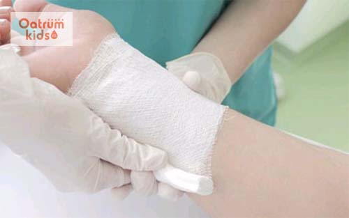  Sử dụng gạc vô trùng băng bó vùng da bị bỏng lạnh