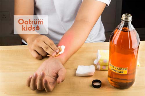  Bỏng hóa chất có thể để lại tổn thương vĩnh viễn