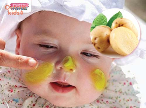 Bài thuốc chữa chàm đỏ bằng khoai tây