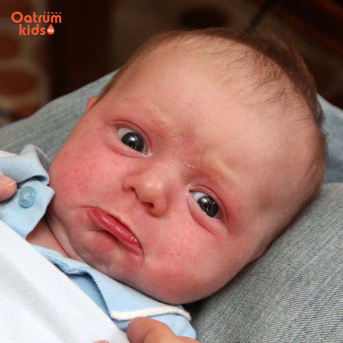 Trẻ bị chàm sữa có thể sử dụng các bài thuốc đông y