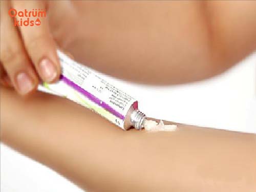 Kem bôi trị côn trùng cắn rất tiện dụng