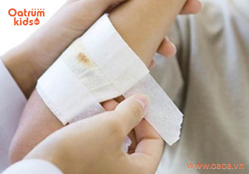 Cầm máu đúng cách giúp trẻ thoát khỏi nguy hiểm
