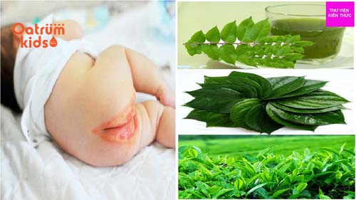 Thuốc trị hăm tã cho trẻ sơ sinh