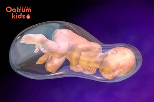   Trẻ sinh ra vẫn còn nằm nguyên vẹn trong bọc ối