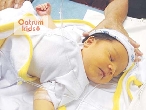  Vàng da ở trẻ sơ sinh là tình trạng phổ biến