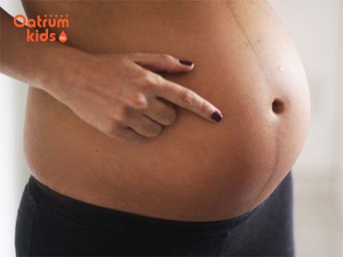  Đường chỉ lông đậm và thẳng sẽ sinh con trai.