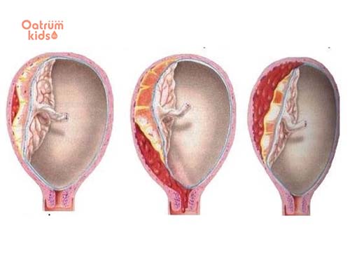 Túi thai là nơi để nuôi dưỡng thai nhi phát triển cho tới khi chào đời.