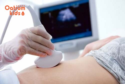 Đo chiều dài xương mũi thai nhi giúp chẩn đoán sớm dị tật bẩm sinh.