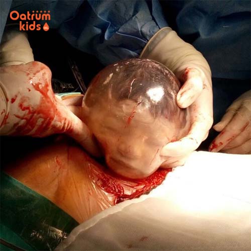  Đây là hiện tượng hiếm gặp và chỉ có thể diễn tả bằng hai chữ “kì diệu”