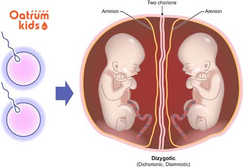  Bổ sung thực phẩm giàu acid folic và sữa sẽ dễ sinh đôi hơn.