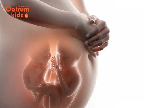  Sinh đôi gồm có sinh đôi cùng trứng và khác trứng.